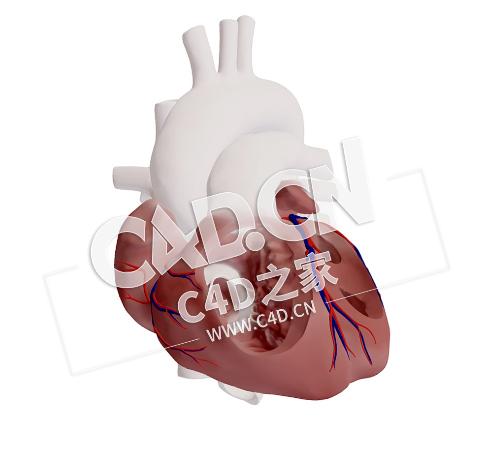 C4D心脏肺部异常肺静脉连接模型 Partial Anomalous Pulmonary Venous Connection - C4D之家 - 01.jpg