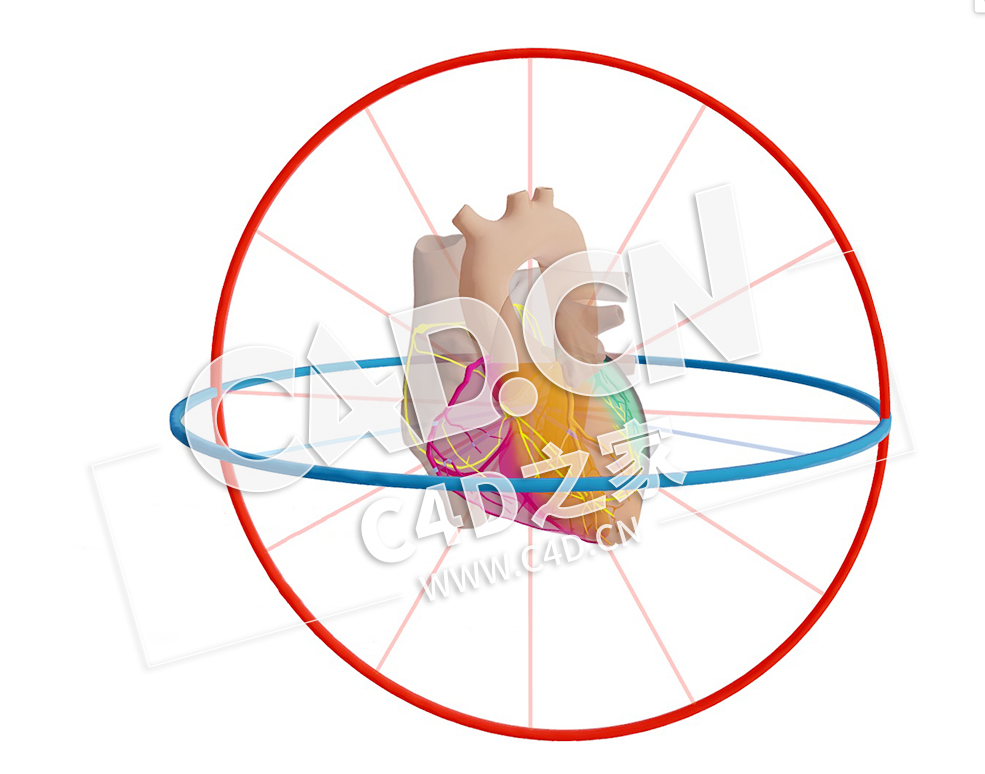 C4D心脏近端梗塞伴分心模型 Proximaal CX Infarct met Afleidingen - C4D之家 - 07.jpg