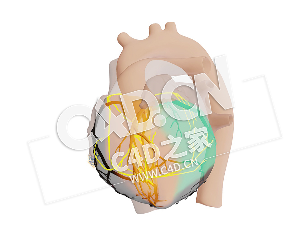 C4D心脏近端右冠状动脉梗塞模型 Proximaal Rechter Coronair Arterie Infarct - C4D之家 - 09.jpg