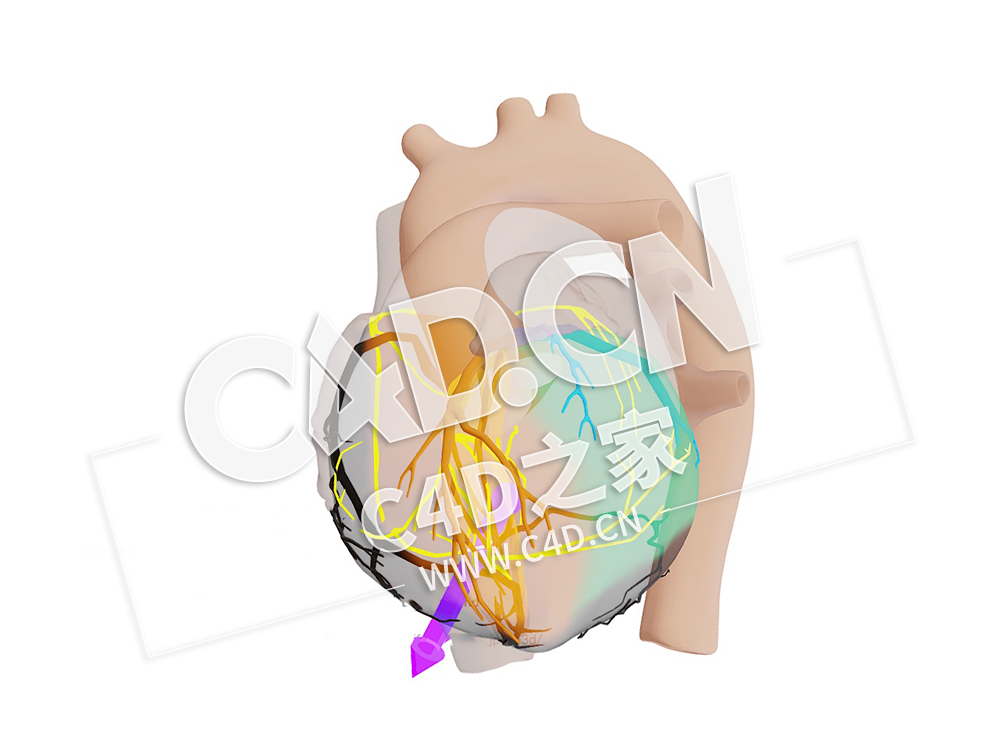C4D心脏RCA梗死模型 RCA Infarct met Vector - C4D之家 - 11.jpg