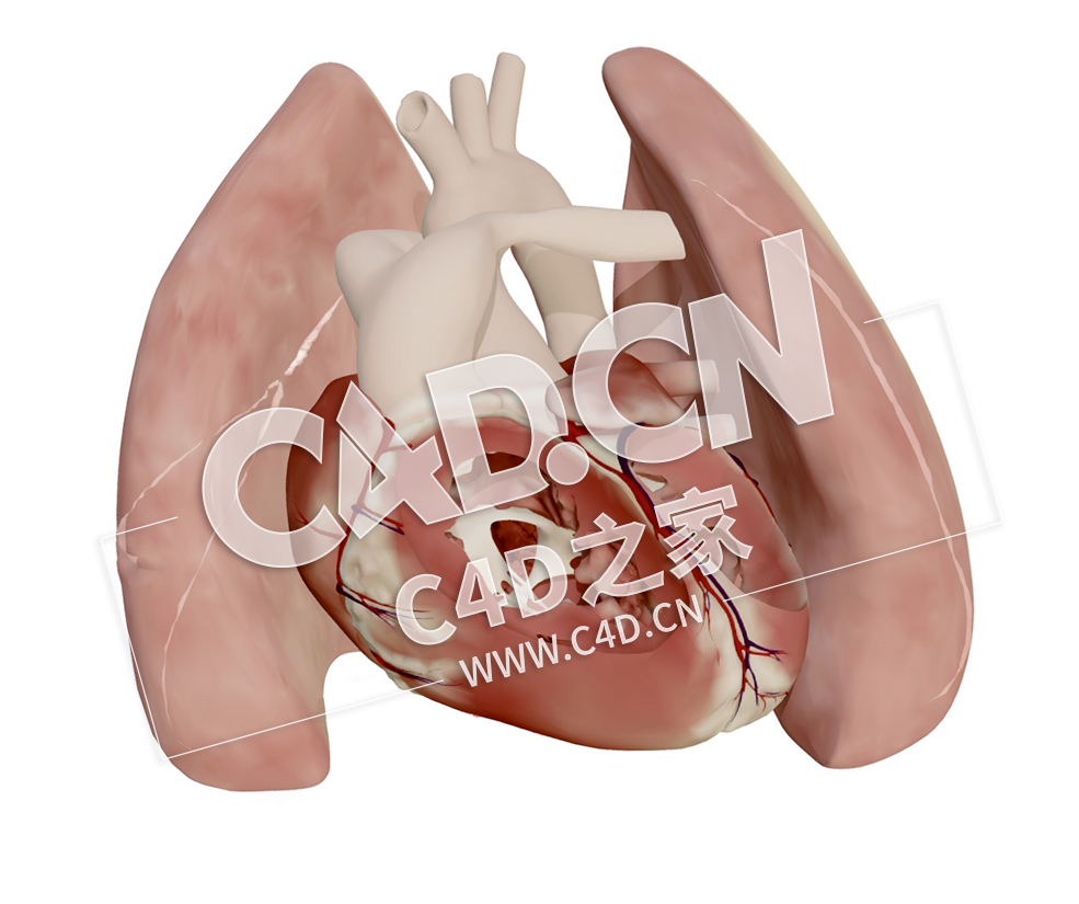 C4D心脏大动脉转位模型 Transposition of the great arteries after switch - C4D之家 - 47.jpg
