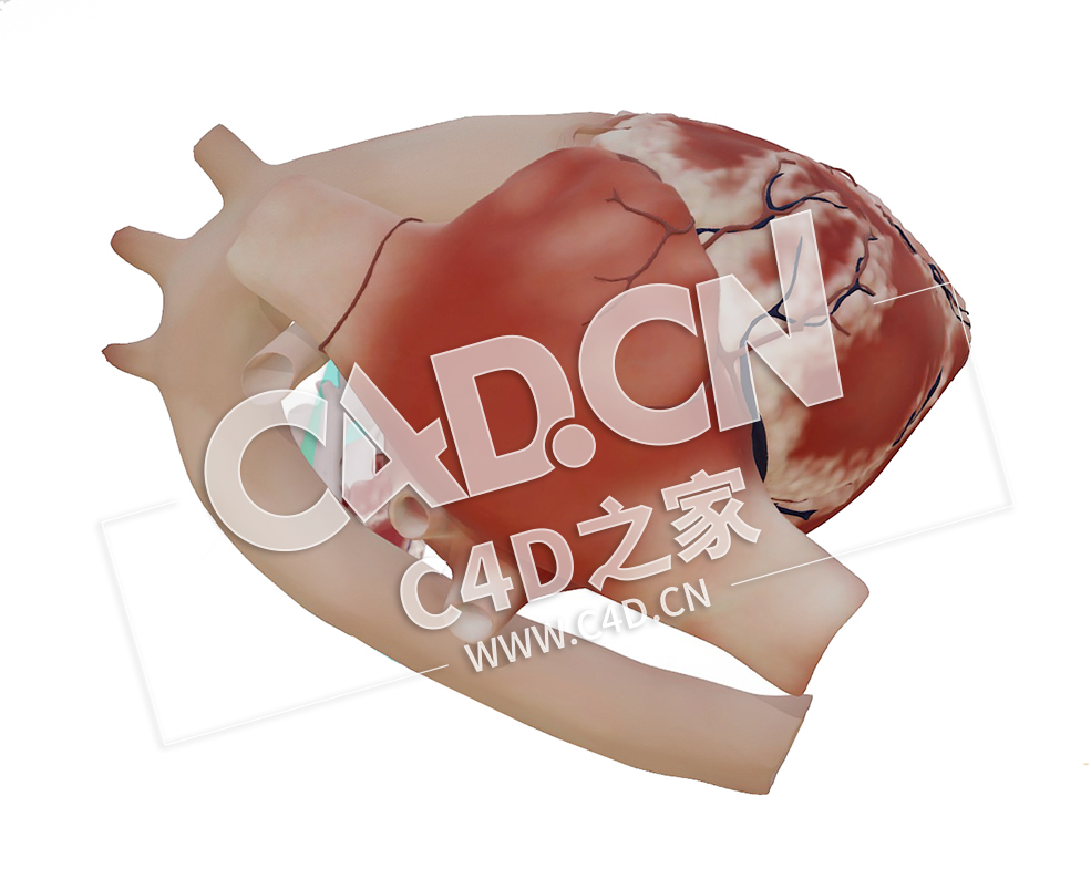C4D心脏大动脉转位长轴模型 Transposition of the Great Arteries, Long Axis - C4D之家 - 48.jpg