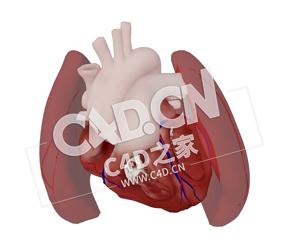 C4D心脏室间隔缺损模型 Ventricular Septal Defect - C4D之家 - 55.jpg