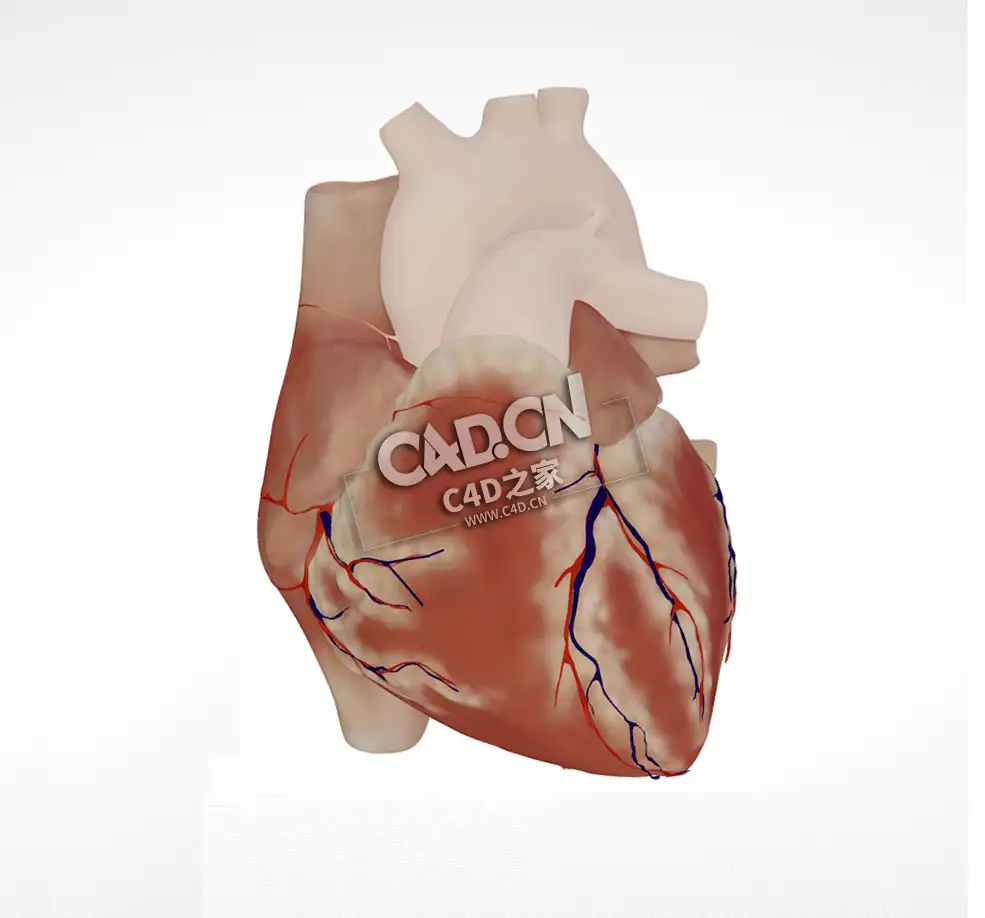人体心脏完全型房室间隔缺损C4D模型下载 Atrioventricular septal defect - C4D之家 - 03.jpg