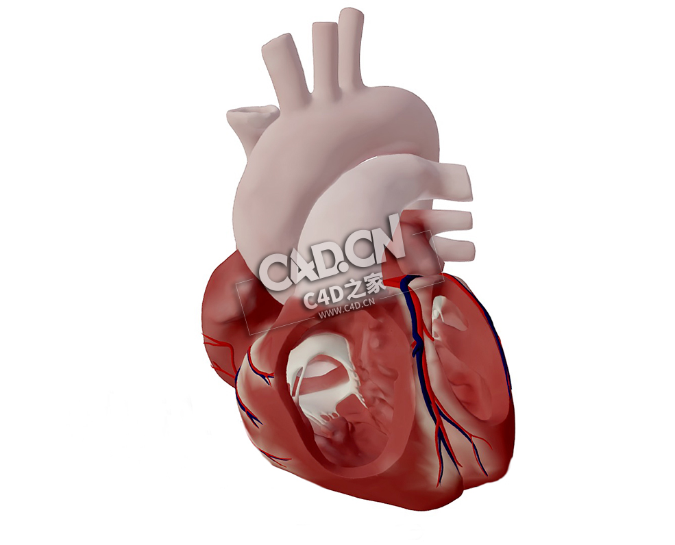 心脏房间隔缺损C4D模型下载 Atrial Septal Defect (ASD)