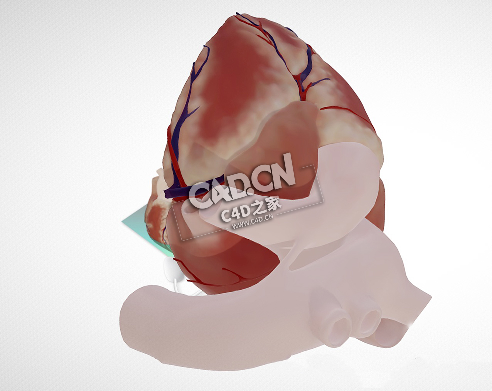 房室间隔缺损四腔视图C4D模型下载 Atrioventricular septal defect, 4 chamber view