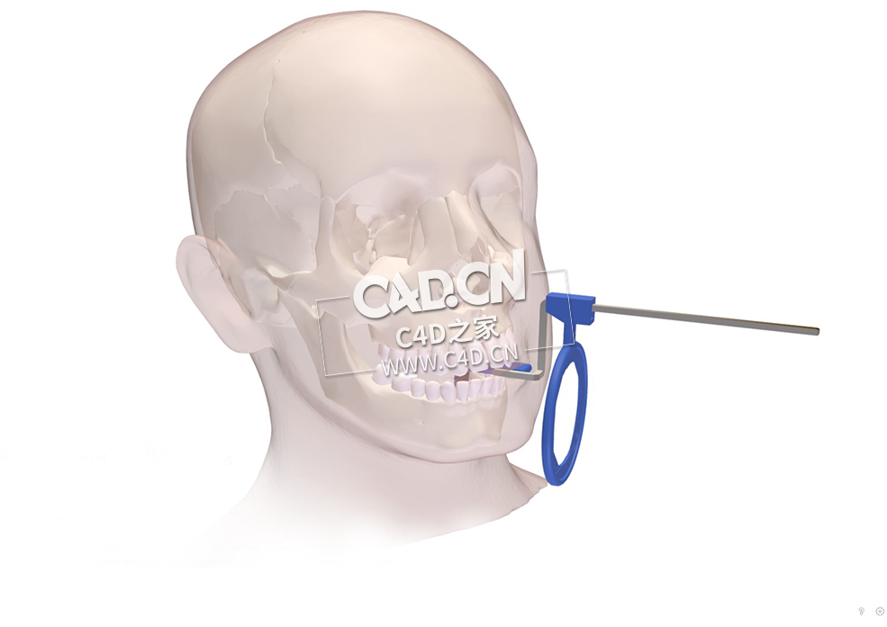 口腔内X光定位器-根尖周C4D模型 Dental Intra Oral X-ray Positioner, Periapical