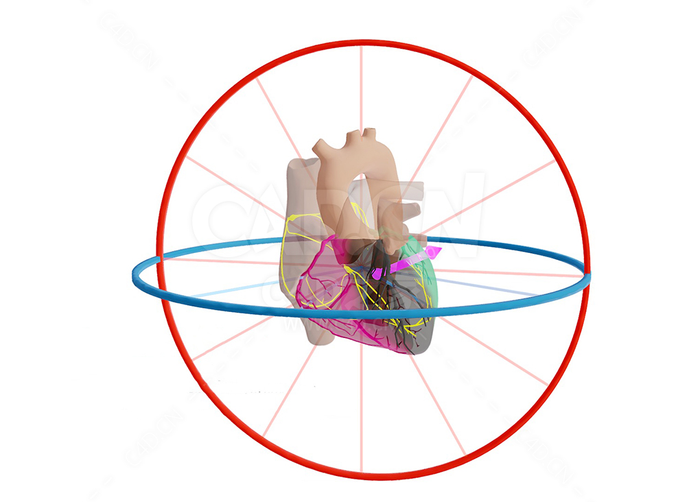心脏 Mid LAD Infarct met Afleidingen en Vector