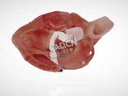 房室间隔缺损C4D模型下载 Atrioventricular septal defect, PSLAX