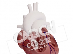 C4D心脏肺部异常肺静脉连接模型 Partial Anomalous Pulmonary Venous Connection