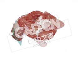 C4D心脏法洛四联症胸骨旁长轴模型 Tetralogy of Fallot, parasternal long axis