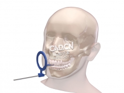 口腔内X射线位置-空注释C4D模型 Dental Intra Oral X-ray Pos - empty annotation