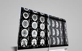 医院医疗器械：X射线板C4D模型 X-Ray-Boards