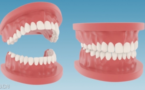 假牙C4D模型 Mode Teeth Dentures