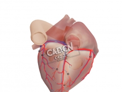 解剖心脏C4D模型下载 Anatomical heart - codominance