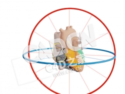 C4D心脏RCA近端阻塞模型 Proximaal infarct RCA met Afleidingen