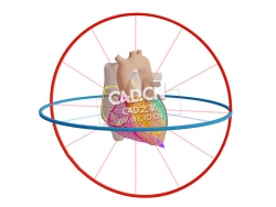心脏CX梗死-甲胎蛋白基因载体C4D模型 CX Infarct met Afleidingen en Vector