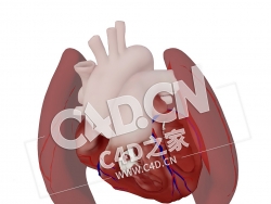 C4D心脏室间隔缺损模型 Ventricular Septal Defect