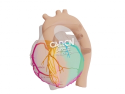 心脏冠状动脉向心室供血C4D模型 Coronary Arteries-Blood Supply to Ventricles