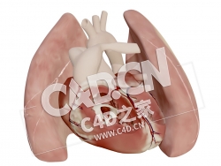 C4D心脏大动脉转位模型 Transposition of the great arteries after switch
