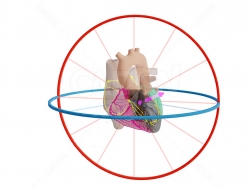 心脏 Mid LAD Infarct met Afleidingen en Vector