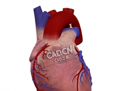 心脏解剖人类心脏外观C4D模型下载 Cardiac Anatomy-External view of human heart
