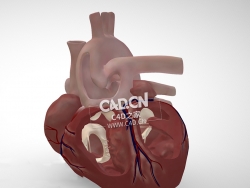 心肺总动脉干C4D模型 Common Arterial Trunk / Truncus Arteriosus