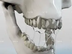 C4D X-Particles骷髅头嘴里的粘液流体动画工程 XPFluids Vol1 Alien Skull Saliva V2