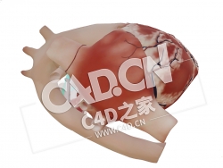 C4D心脏大动脉转位长轴模型 Transposition of the Great Arteries, Long Axis