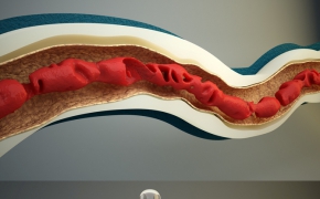 C4D镂空腐蚀脚本 Aire et volume