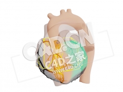 C4D心脏近端右冠状动脉梗塞模型 Proximaal Rechter Coronair Arterie Infarct