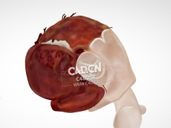 心脏解剖主动脉瓣回声平面C4D模型 Cardiac Anatomy-PSAX Aortic Valve echo plane