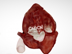 心脏解剖另一半心尖5腔C4D模型 Cardiac Anatomy-Other Half Apical 5 Chamber