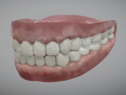 人牙齿 Human teeth