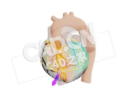 C4D心脏RCA梗死模型 RCA Infarct met Vector