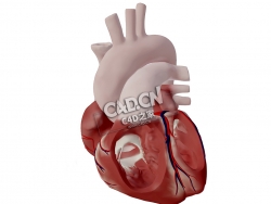 心脏房间隔缺损C4D模型下载 Atrial Septal Defect (ASD)