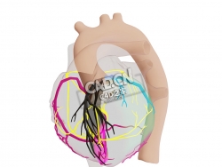 心脏中段梗死C4D模型下载 Mid LAD Infarct